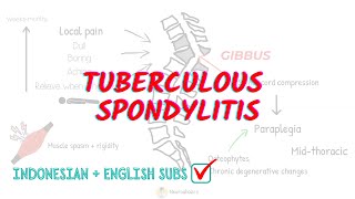 Tuberculous Spondylitis Overview and Treatment [upl. by Tannenwald]