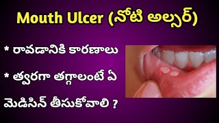 Mouth Ulcers Reasons and Treatment in Telugu [upl. by Lraed]