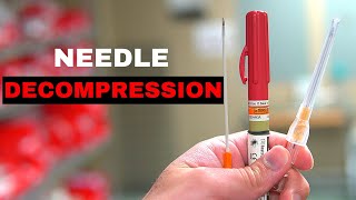 How To Chest Needle Decompression [upl. by Hirsch]