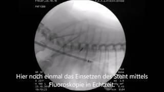 Trachealkollaps des Hundes  Diagnose amp Therapie [upl. by Assinna]