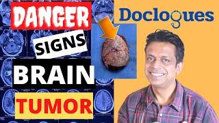 Brain Tumor Types and Treatment  Dr Amitabha Chanda Hindi [upl. by Aryt]