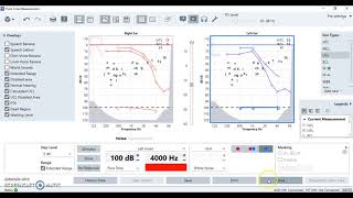 Understanding a Hearing Test [upl. by Venola372]