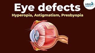 Eye defects  Hyperopia Astigmatism Presbyopia  Dont Memorise [upl. by Yltnerb]