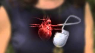 Cardiovascular  Electrophysiology  Intrinsic Cardiac Conduction System [upl. by Jillene]