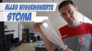 Stoma  Wissenswerte  Pflege Kanal [upl. by Juliano]