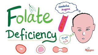 Folate deficiency  Megaloblastic Anemia  Macrocytic  Hematology Series [upl. by Atilehs]