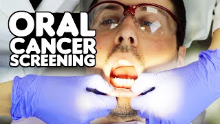 How Oral Cancer Screenings Are Performed [upl. by Enwad885]