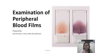 Examination of Peripheral Blood Smears [upl. by Vergos944]