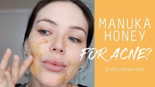 I tried manuka honey for acne  hyperpigmentation  Nicole Masifilo [upl. by Niela]