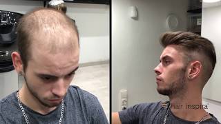 Hair Replacement fitting video David part 2 – Hair Inspira [upl. by Anyehs]