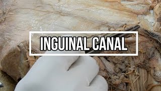 Inguinal Canal [upl. by Dnaloy]