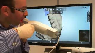 Intra Oral scanning with 3Shape TRIOS [upl. by Aicilef]