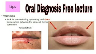 Intraoral Examination Oral Diagnosis [upl. by Bobker]