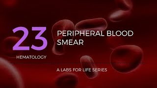 Part 1  Preparation of Peripheral Blood Smear PBS [upl. by Elleirda]