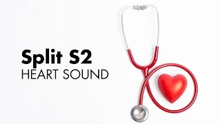 Fixed Split S2  Heart Sounds  MEDZCOOL [upl. by Munroe]