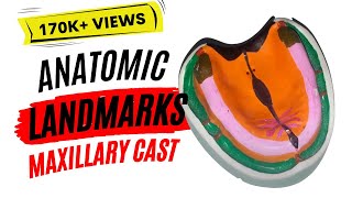 Lets Learn Anatomic landmarks in maxillary cast [upl. by Laehcim304]