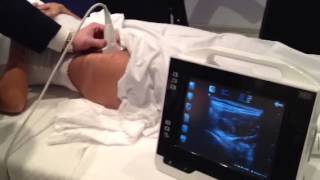 UltrasoundGuided Hip Injection [upl. by Nitsirc]