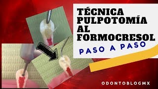 Técnica PULPOTOMÍA AL FORMOCRESOL  paso a paso [upl. by Russo]