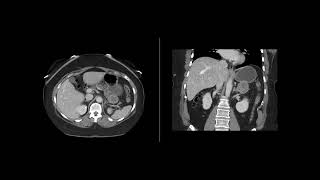 Tumor Markers In Cancer Diagnosis  Tumor Marker Tests [upl. by Akkin]