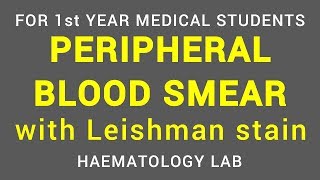 PERIPHERAL BLOOD SMEAR  LEISHMAN STAIN  HAEMATOLOGY LAB  PHYSIOLOGY [upl. by Baxter829]