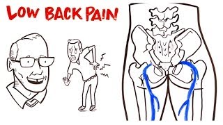 Low Back Pain [upl. by Apilef192]