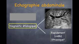 Pancréatite aiguë  1 Diagnostic positif [upl. by Aerdma]