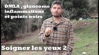 DMLA  glaucome inflammations et points noirs  Soigner les yeux épisode 2  regenereorg [upl. by Perzan860]