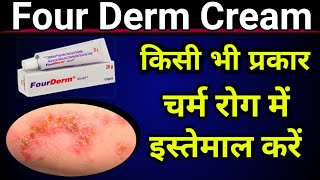 Four Derm Cream Uses in Hindi  Skin Infection Solution  पूरे जानकारी हिंदी  Full Review [upl. by Asiralc]