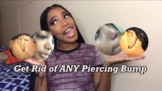 How to Get Rid of ANY KeloidPiercing bump FAST no tea tree oil JUSTTRISH [upl. by Airamanna]