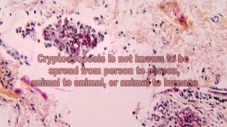 Cryptococcus Fungi The Cause of Cryptococcosis [upl. by Harima]