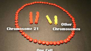 Nondisjunction Trisomy 21  An Animated Tutorial [upl. by Cinemod803]