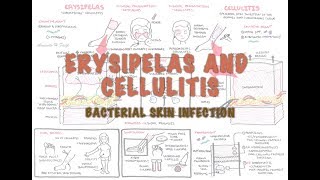 Mycosis Fungoides Cutaneous TCell Lymphoma 5Minute Pathology Pearls [upl. by Letnoj]