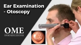 Otoscopy Ear Examination  ENT [upl. by Heinrick34]