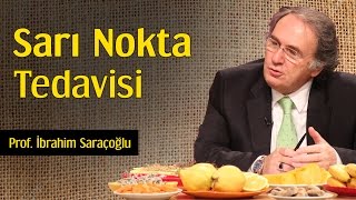 Sarı Nokta Tedavisi  Prof İbrahim Saraçoğlu [upl. by Madalena]