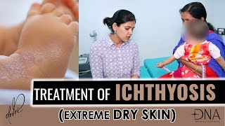 What is ichthyosis  Ichthyosis Causes Symptoms amp Treatment  Dr Priyanka Reddy [upl. by Leirad]