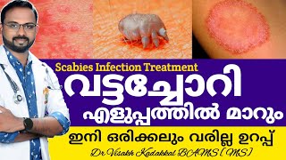 വട്ടച്ചോറി മാറാൻ  Vattachori Maran  Scabies infection CausesSymptomsTreatment  DrVisakhKadakkal [upl. by Matheny733]