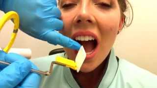 How to Take Periapical Radiographs [upl. by Anertak]