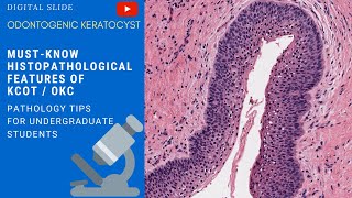 Odontogenic Keratocyst Histopathology [upl. by Anayeek]