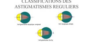 BIOPHYSIQUE Astigmatisme [upl. by Eugenia]