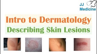 4 Primary and Secondary skin lesions [upl. by Vieva]