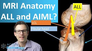 Knee MRI anatomy Anterolateral Ligament and AIML [upl. by Brotherson832]