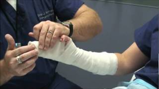 Splint Workshop 3  Ulnar Gutter Splint [upl. by Madalena]