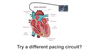 CARDIAC PHYSIOLOGY PART 2 by Professor Finkwmv [upl. by Nallac]