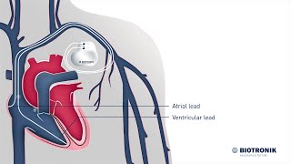 Pacemaker Cells of the Heart  Cardiology [upl. by Lachman]