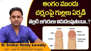 అంగంపై ఇలా ఉందా  Best Treatment For Balanitis in Telugu  Diabetes  Treatment Range Hospital [upl. by Dnallor588]