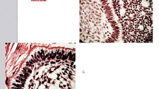 Odontogenic Tumors [upl. by Ojok602]