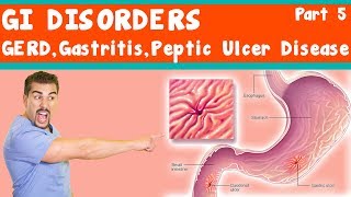 GI Disorders GERD Gastritis peptic ulcer Disease Part 5 [upl. by Nea]