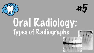 Oral Radiology  Types of Radiographs  INBDE ADAT [upl. by Riegel563]