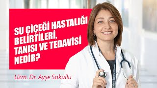 Su çiçeği hastalığı belirtileri tanısı ve tedavisi nedir [upl. by Atnicaj425]