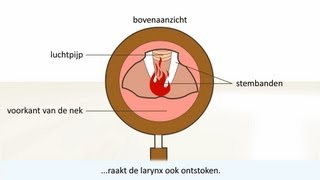 Keelontsteking  de oorzaak en behandeling [upl. by Gierk268]